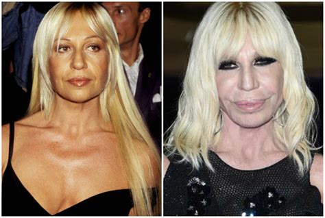 donatella versace prima e poi|Donatella Versace: biografia e carriera della stilista .